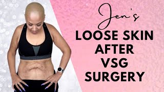 QUALITY OF LIFE with LOOSE SKIN AFTER VSG SURGERY