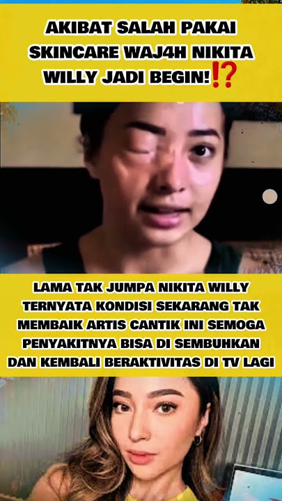 Get well soon #nikitawilly