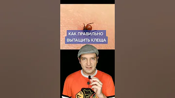 Как правильно вытащить клеща #shorts