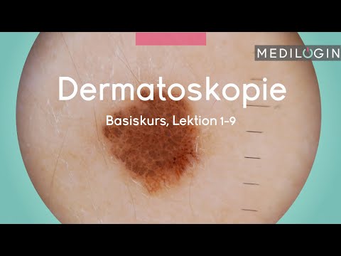 Dermatoskopie (Basiskurs) | MEDILOGIN