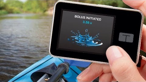 These companies are racing to make an artificial pancreas