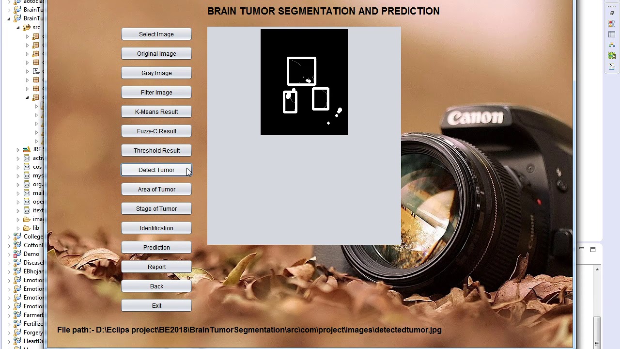 Similarity Measure-Based Possibilistic FCM With Label Information for Brain MRI Segmentation