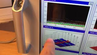 T/Q-Pulse UHF Noise Suppression PD Comparison Test