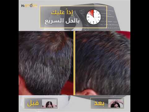 01 سيروم زيت الشيب  01 سيروم زيت الشيب