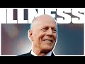 Bruce Willis Has a Really Terrible Illness Aphasia - What Is This Brain Condition?