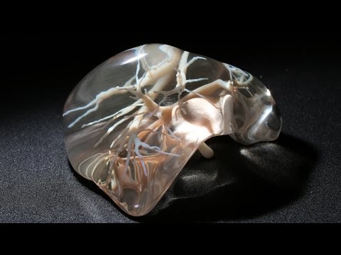 ３Ｄプリンターで肝臓の模型を製造