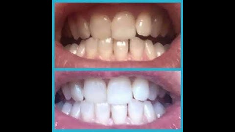 AP24 Whitening Toothpaste