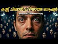 കണ്ണ് ചിമ്മാൻ കഴിയാത്ത മനുഷ്യർ 👀🚫 | The People Who Never Blink | Stotrees