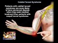 Cubital Tunnel Syndrome - Everything You Need To Know - Dr. Nabil Ebraheim