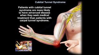 Cubital Tunnel Syndrome  Everything You Need To Know  Dr. Nabil Ebraheim