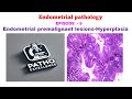 Endometrial Pathology | Episode 9: Endometrial Hyperplasia – Premalignant Lesions Explained