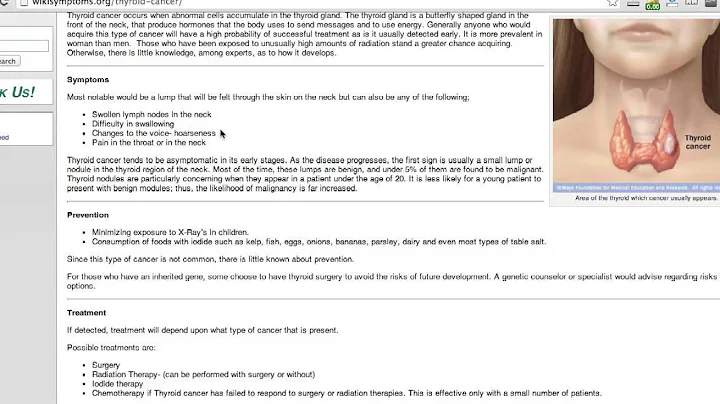 Thyroid Cancer Prevention | wikiSymptoms