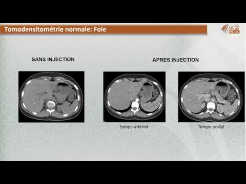FMPM MOOCs -  Radiologie digestive, Imagerie du foie - Pr. N. Cherif Idrissi El Ganouni