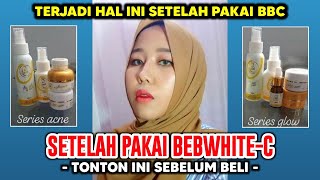 Review Bebwhite c bbc skincare glow acne series