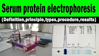 Serum protein electrophoresis (Definition,principle,types,procedure,results)