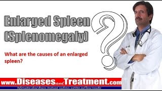 Enlarged Spleen (Splenomegaly): What are the causes of an enlarged spleen?