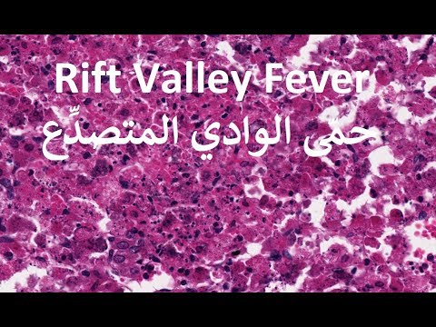 Rift Valley Fever Arabic حمى الوادي المتصدع بالعربي