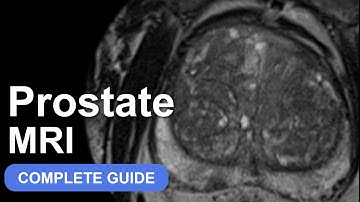 Introduction to Prostate MRI and PI-RADS: Approach and Principles