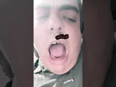 حسام عبد المجيد أهلاوى زينا شاهد التفاصيل رسميا