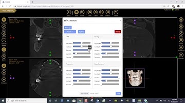 Training: Apteryx XVWeb 3D: Basic Image Enhancements