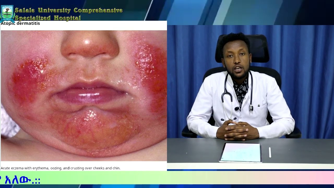 የጤና መረጃ ሰለ ቆዳ በሽታ