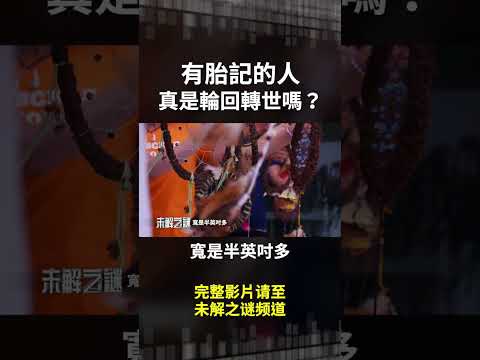 有胎记的人 都有轮回转世?