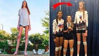 Как выглядит 18-летняя девушка с самыми длинными ногами в мире!