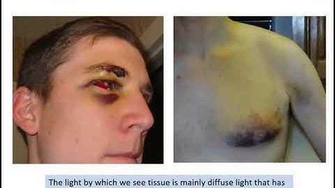 Lecture Dick Sterenborg Elastic Scattering Spectroscopy Part 1