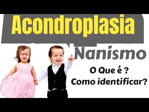Principais Doenças Genéticas - Acondroplasia ( Nanismo)