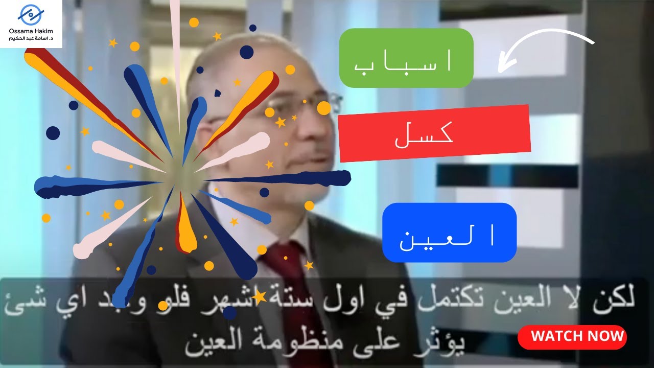 أسباب خمول العين (كسل العين) خطورته وطريقة علاجه