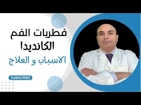 علاج فطريات الفم الكانديدا و اهم اسبابها
