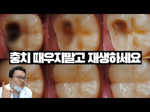17년차 치과의사가 알려주는 치아재생 기술의 현주소.