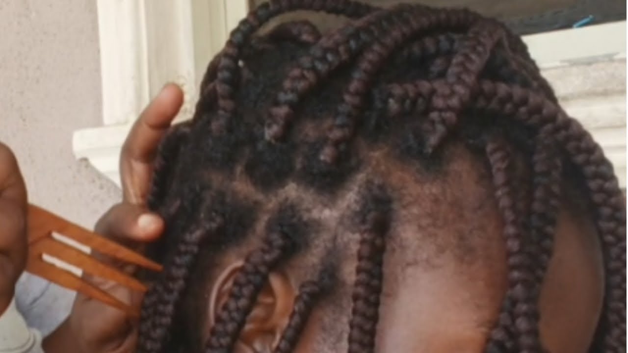 ASMR deep scalp scratching,scalp hair line check and oiling for relax sleep 😴