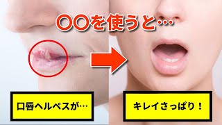 口唇ヘルペスの治し方、自力で治すには〇〇が有効！【豆知識】