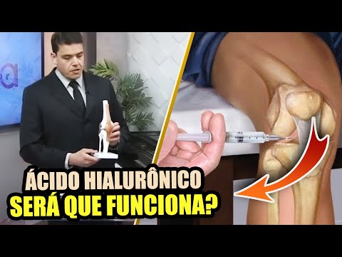 INFILTRAÇÃO COM ÁCIDO HIALURÔNICO FUNCIONA? - Novidades no tratamento da ARTROSE