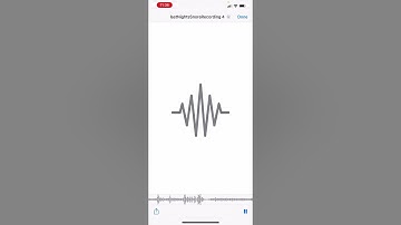 Listen to a normal snore versus a sleep apnea snore