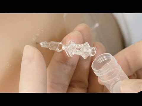 Video: Ved lumbalpunktur stikkes nålen ind imellem?