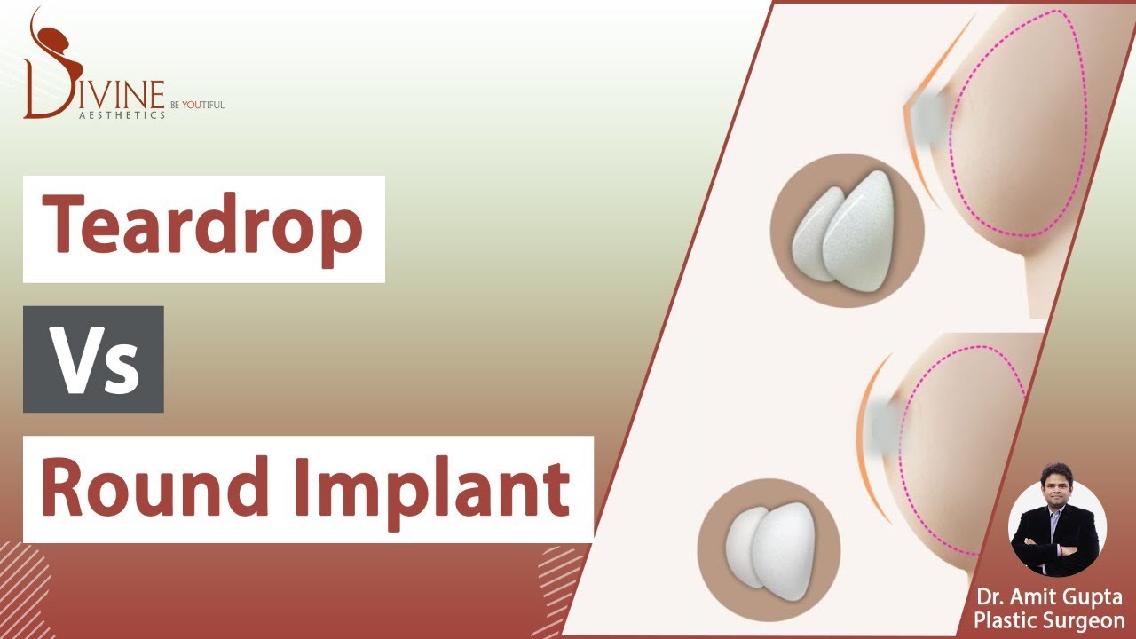 Breast implant shapes Teardrop shape and Round shape. cosmetic