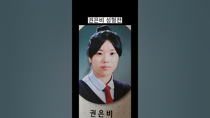 권은비 성형전 성형 후