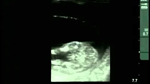 Cow #4539 Day 72 of Gestation