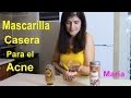 MASCARILLA  PARA EL ACNE | LADYMARIA51