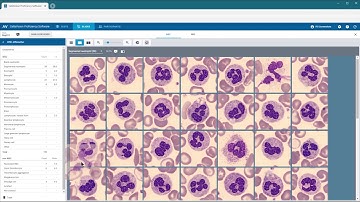 How to prepare slides for tests | CellaVision
