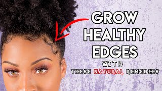 THICKEN UP THEM EDGES! Grow Your Edges Back W/ These Natural Remedies!