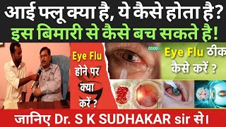 Eye Flu ठीक कैसे करें Conjunctivitis को कैसे ठीक करें कैसे कर सकते हैं  Eye flu thik kaise kre 