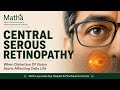 Central Serous Retinopathy Often Starts With Distorted Vision. Understanding How Ayurvedic Eye Treat