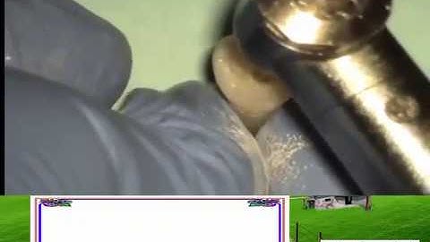 B.D: Mở tủy răng cối nhỏ hàm dưới(Carlos Praco)