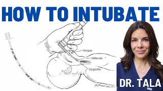 Neonatal intubation made SUPER EASY// Step-by-step instructions!!