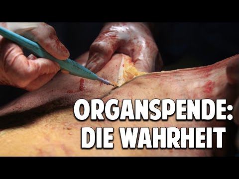 Organdonation: Den skjulte sandhed