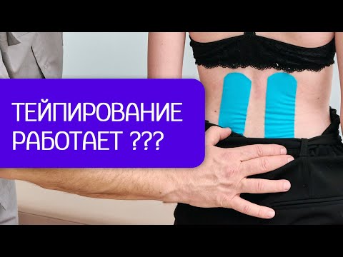 Тейпирование не помогает?! Разбираемся в методе.