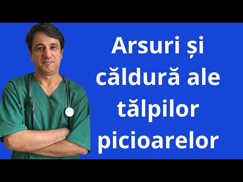 Video: 4 moduri simple de a ameliora durerea piciorului de a sta toată ziua în picioare